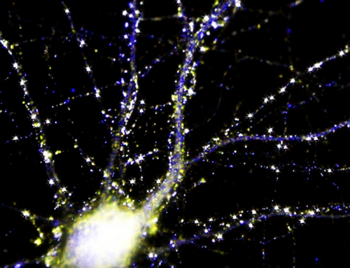 Synapses of a cultured neuron